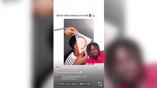 HE DID THIS TO HIS HAIRLINE! #tiktok #viral #share