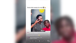 HE DID THIS TO HIS HAIRLINE! #tiktok #viral #share