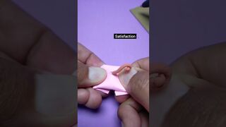 The Most Epic Pimple Squeeze Compilation! #shorts #satisfying #diy