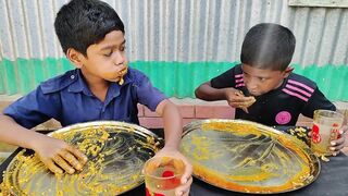 Eating Challenge || Egg Omelet Curry with Rice Eating Challenge || Eating Competition