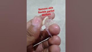 flexible Remove able partial denture #partialdenture