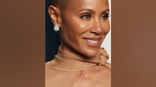 Jada Pinkett Smith Alopecia Journey Update #celebrity #alopecia #jadapinkettsmith #hairjourney