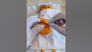 Cesarean Section #youtubeshorts #viral #instagram #instagood #shortvideo #shortvideo #insta #reels