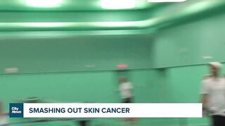 Celebrity fundraiser hoping to help end skin cancer