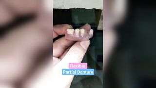 Removable Flexible Partial Denture By Haider #dentalartbyhaider #rpd #dentures #dentist