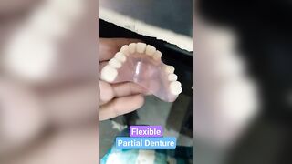 Upper Flexible Partial Denture By Haider #dentalartbyhaider #rpd #dentist #dentures