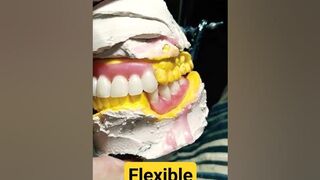 Flexible Partial Denture Set-up By Haider #dentalartbyhaider #rpd #dentures #dentist