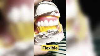 Flexible Partial Denture Set-up By Haider #dentalartbyhaider #rpd #dentures #dentist