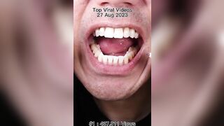 ???? Champion of Chewing ASMR Compilation! #Long #Compilation #ASMR #Satisfying #Best #Viral