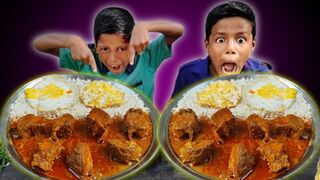 Spicy Chicken Curry, Egg Omlet with Rice Eating Challenge/Competition || Eating Fight