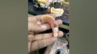 Flexible Partial Denture