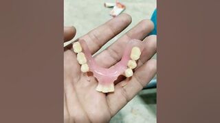 Flexible Partial Denture come For Addition interior Teeth ????