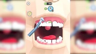 Dentist Blink Game ✅ Max All Levels Top Free Games New Update Gameplay NYTEBITO