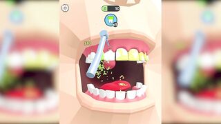 Dentist Blink Game ✅ Max All Levels Top Free Games New Update Gameplay NYTEBITO