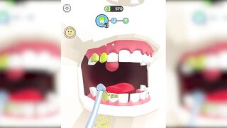 Dentist Blink Game ✅ Max All Levels Top Free Games New Update Gameplay NYTEBITO