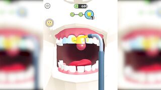 Dentist Blink Game ✅ Max All Levels Top Free Games New Update Gameplay NYTEBITO