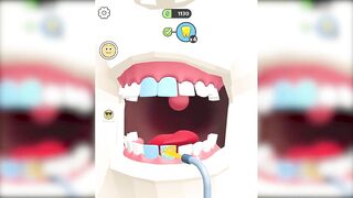 ✅ Dentist Blink Game Max All Levels Update New Level Free Games SILTBUXW