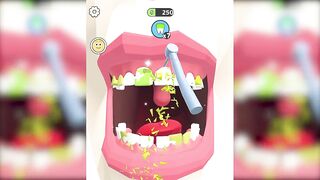 ✅ Dentist Blink Game Max All Levels Update New Level Free Games SILTBUXW