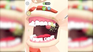 ✅ Dentist Blink Game Max All Levels Update New Level Free Games SILTBUXW