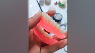 Flexible complet Denture