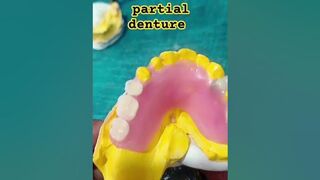 flexible partial denture by Ali dental ceramic #partialdenture #completedenture #removabledenture