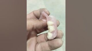 Lower Flexible Partial Denture By Haider ????????????#rpd #dentures #dentalartbyhaider #