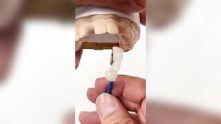 flexible teeth | #shortsfeed #dentist #shorts