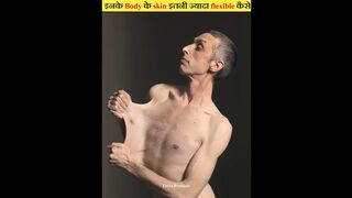 इनके Body के Skin इतना ज्यादा flexible कैसे हो गया? #shorts #factoprakash