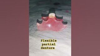 flexible partial denture by Ali dental ceramic #completedenture #removabledenture #partialdenture