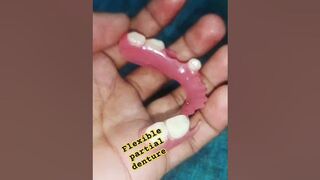 flexible partial denture by Ali dental ceramic #orthodontist #dentist #partialdentures #teeth