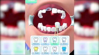 Perfect Smile Game ✅ Max All Levels Gaming Top New Games Gameplay UKOPWRW