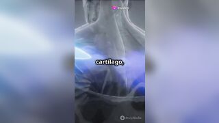 ¡El Hombro La Articulación Más Flexible del Cuerpo!