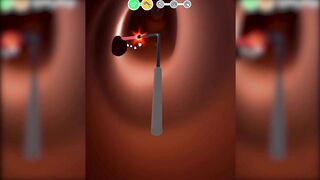 Earwax Clinic Game Max All Levels Update New Top Android Games 183KAEQXUYT