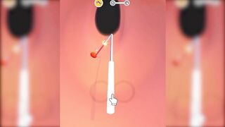 Earwax Clinic Game Max All Levels Update New Top Android Games 183KAEQXUYT