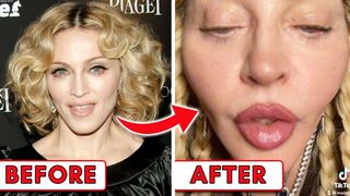 Plastic Surgeon Reacts To Madonna's Unrecognizable TikTok